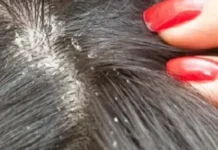 Para se t’ju futë kryehajduti në BE merrni këshilla të mbytni morrat e kokës por edhe të shmagni vizitën tek doktori…