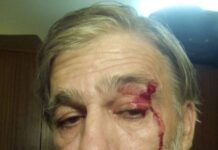 3 patronazhistë të Edi Ramës dhunojnë muzikantin anti mafie, konservatorin Ilir N Dardani në Francë