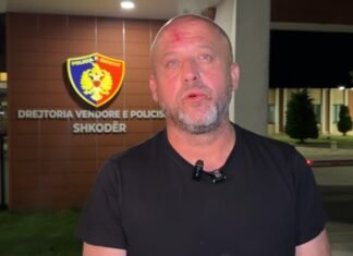 Shqipëri, rrah gazetarin, helmo popullin